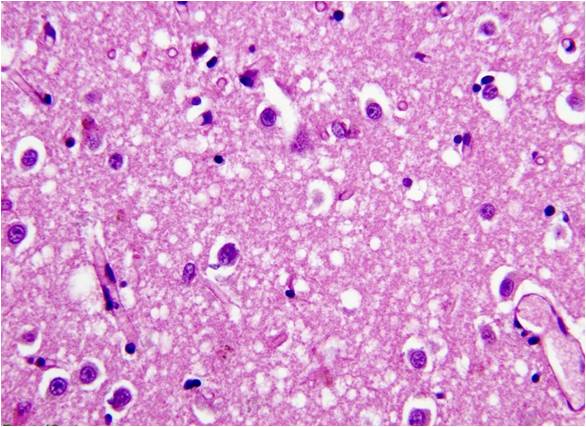 Legionnaires’ disease bacteria found in Maine water samples